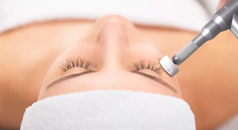 Professional MicroChanneling treatment